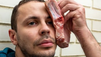 Filmový nesmysl: Proč byste si na poraněný obličej neměli dávat syrové maso
